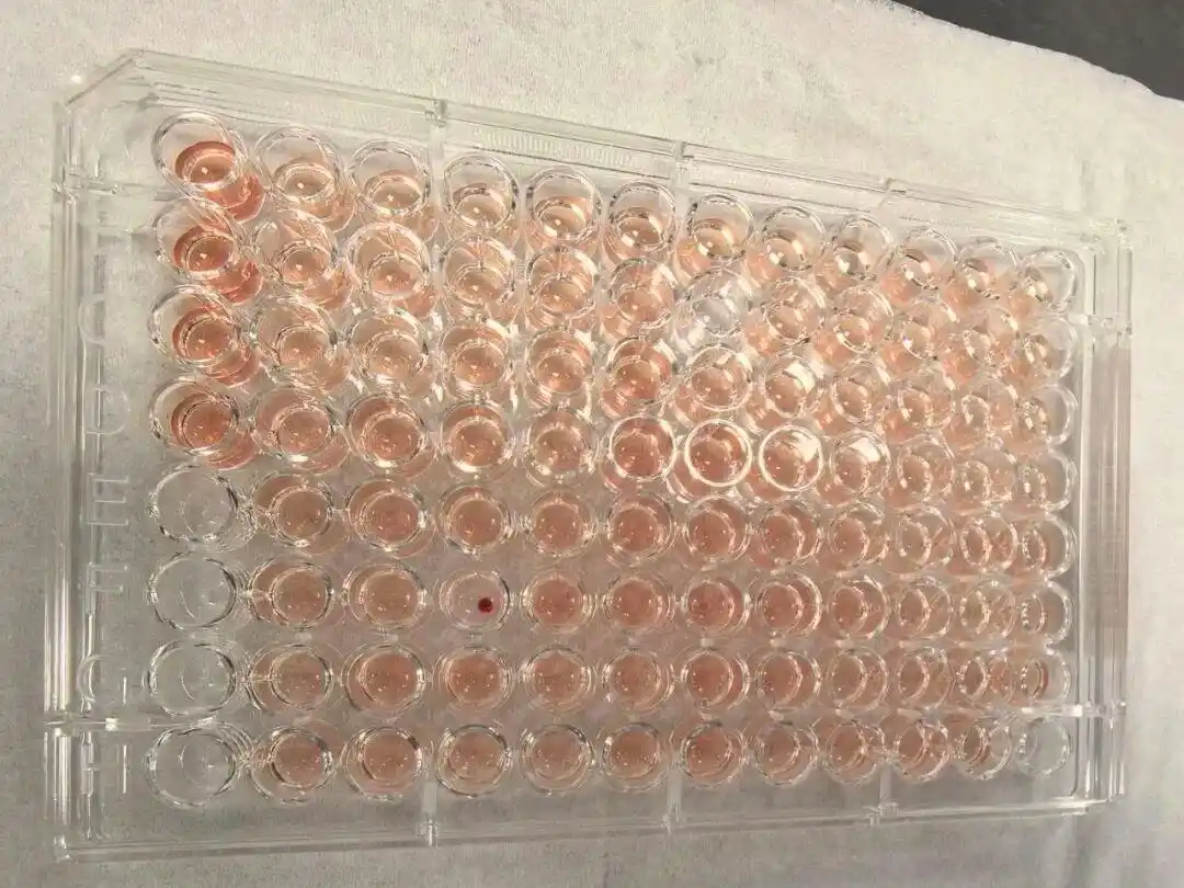 佛山顺德现钻石血Jk(a-b-)，稀有度超熊猫血百倍！填补筛查空白
