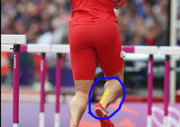 刘翔受伤原因_刘翔右腿伤痛分析_刘翔伦敦奥运会栏杆高度问题