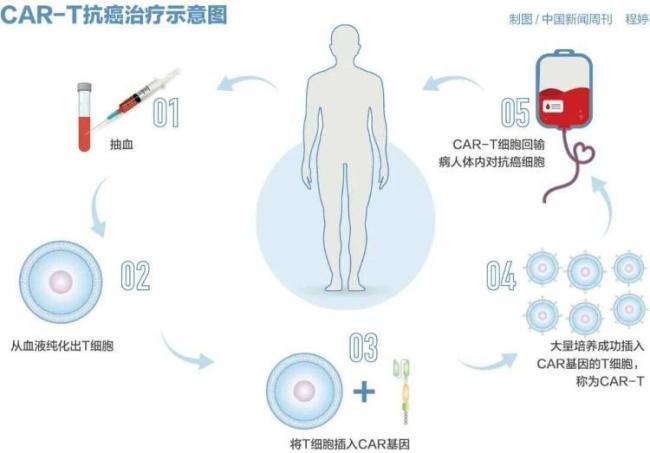 一针百万元的抗癌药有望大幅降价