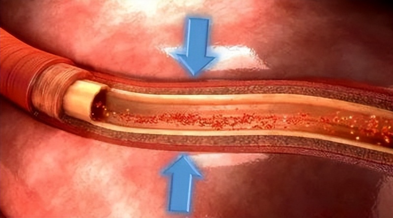 早上跑步空腹可以吗_晨跑心血管系统压力变化_晨跑呼吸系统功能提升