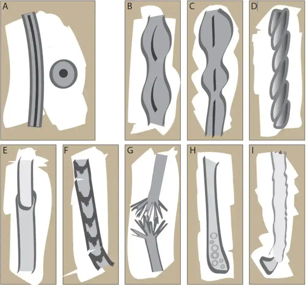 头发分叉_毛干异常_头发开叉其实是种病