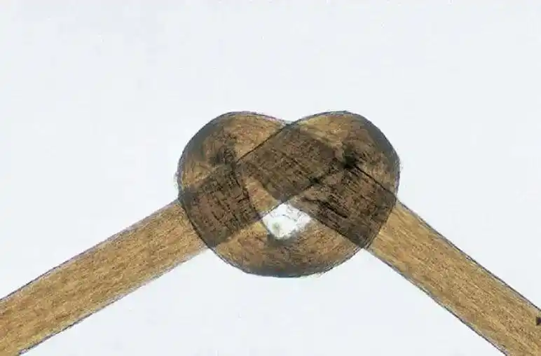 头发开叉其实是种病_头发分叉_毛干异常