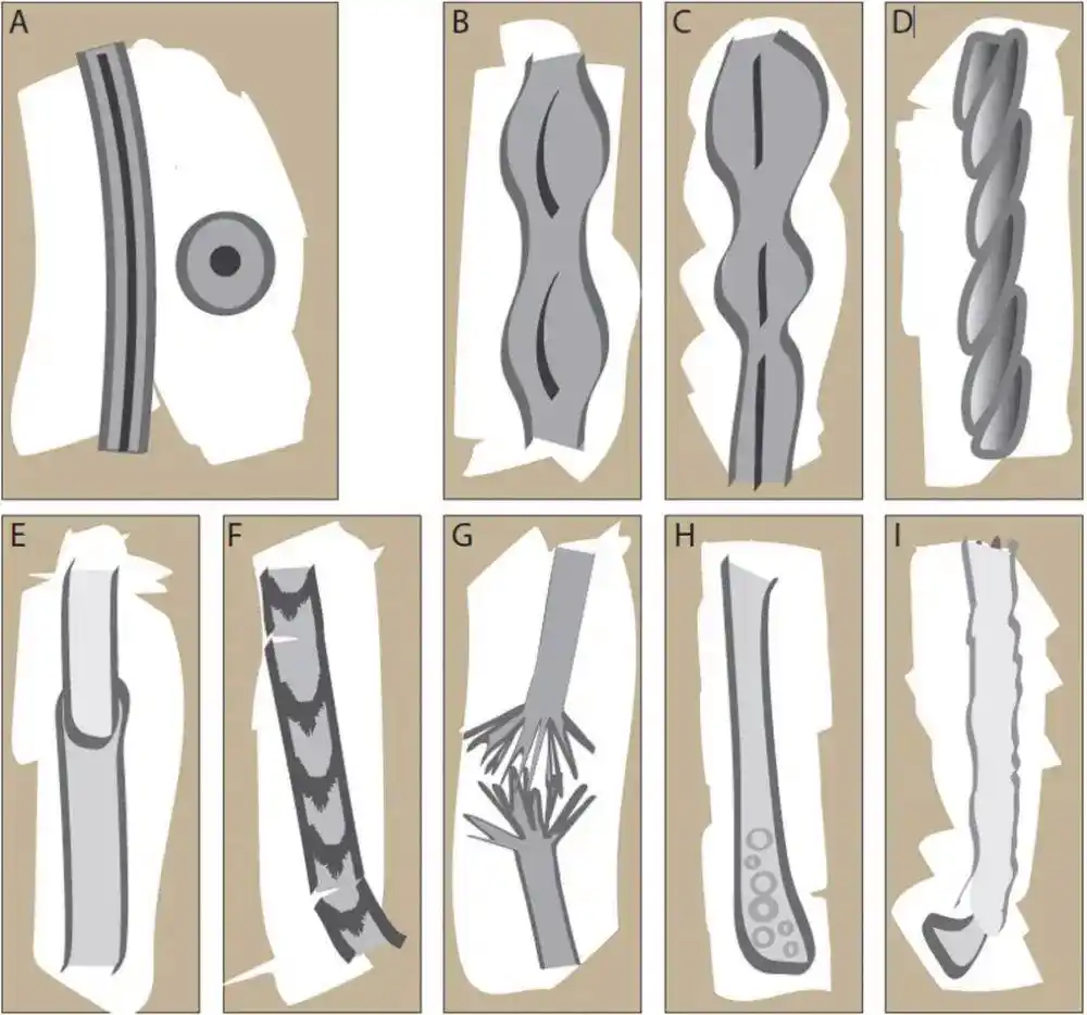 头发开叉其实是种病_头发分叉原因_毛干异常修复方法