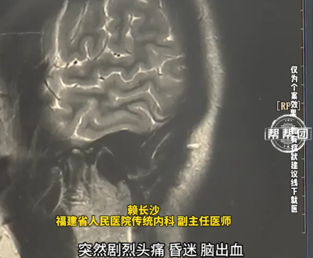 绿豆汤喝法错误危及生命_高温天绿豆汤当水喝解暑？医生提醒_高血压患者喝绿豆汤注意事项