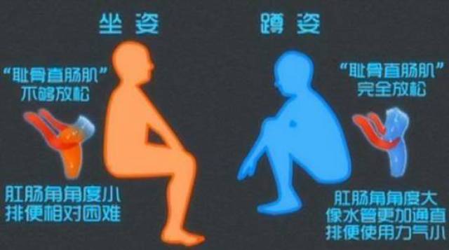 蹲坑健康_亚洲蹲_马桶蹲便