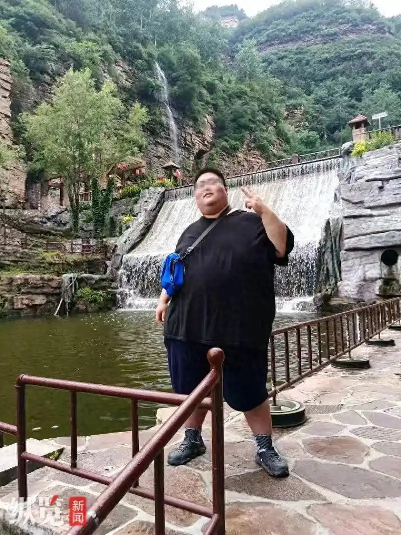 邯郸小伙心情不好暴饮暴食胖至510斤,不能躺着睡觉走80米就喘,无奈做手术减肥,本人:希望能瘦到240斤