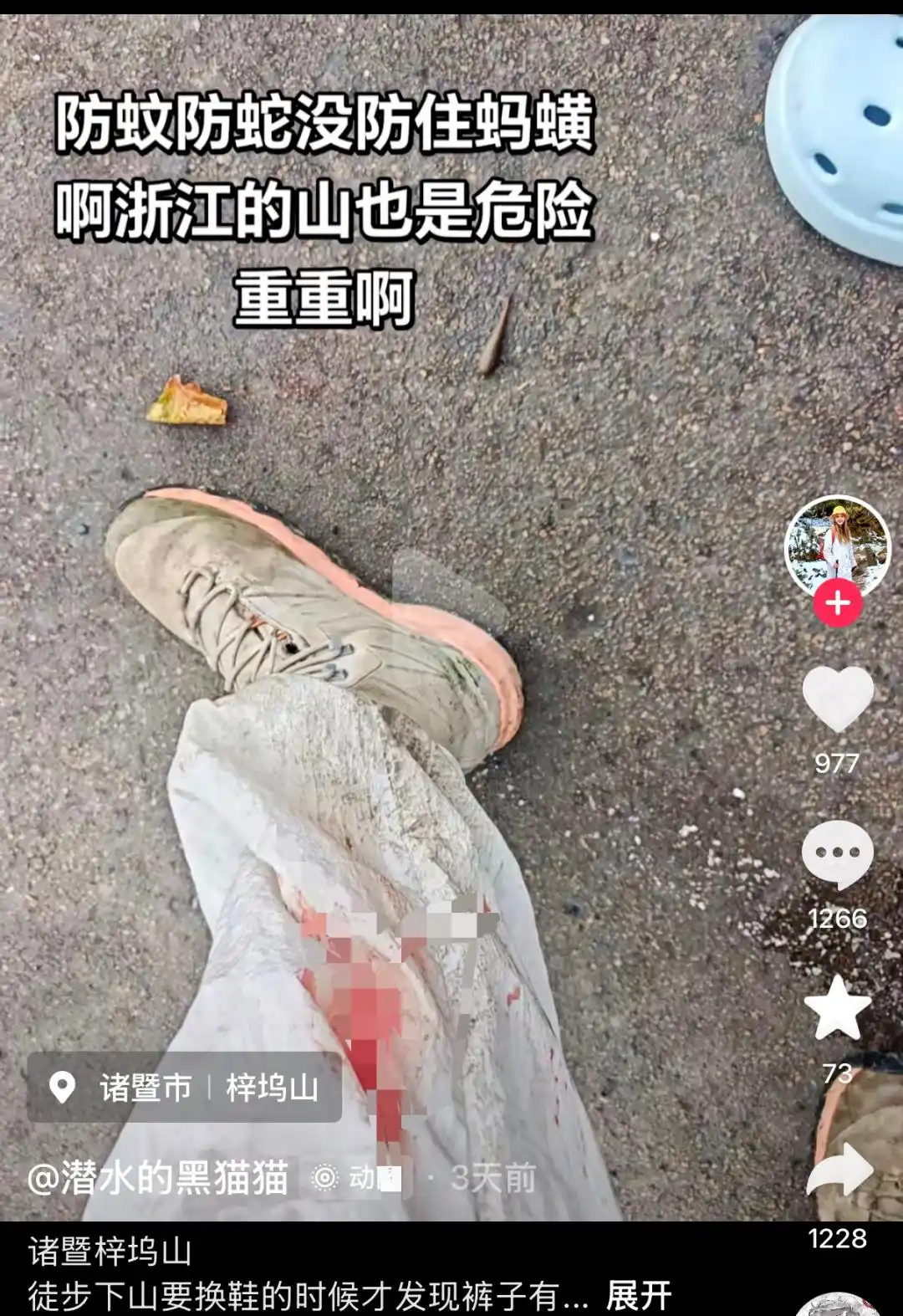 徒步被蚂蟥咬伤处理方法_蚂蟥的医用价值介绍_女子山间徒步遭蚂蝗吸血全程无感