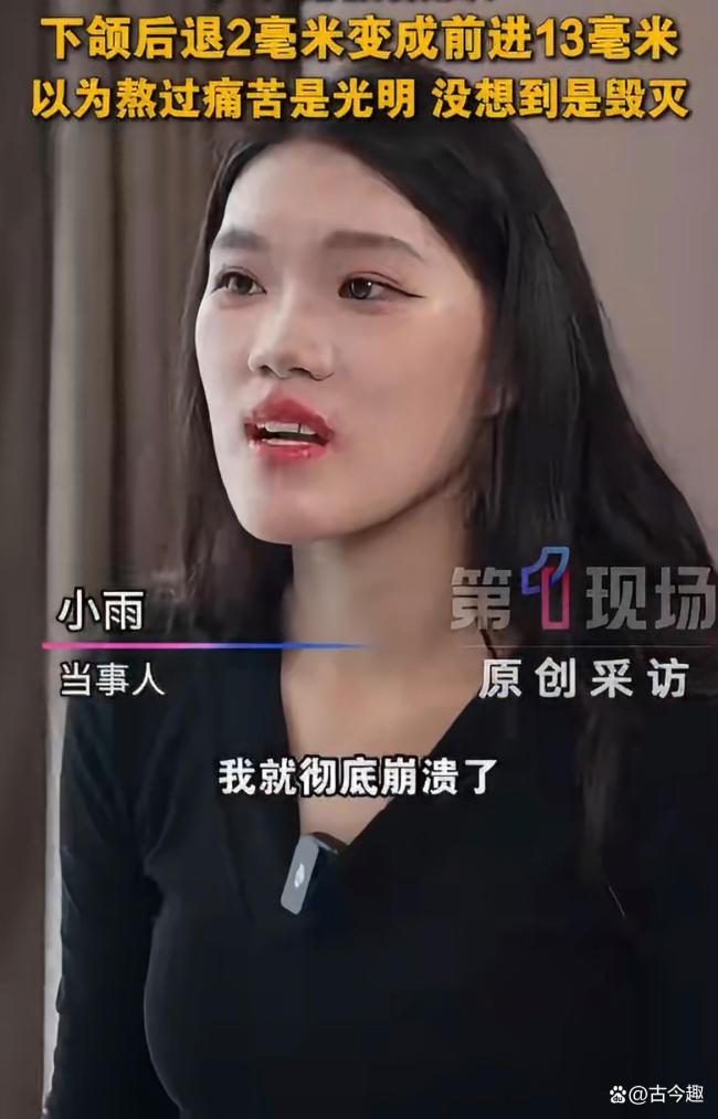 女孩正颌手术被做反 当事医生已停诊 医美悲剧引深思